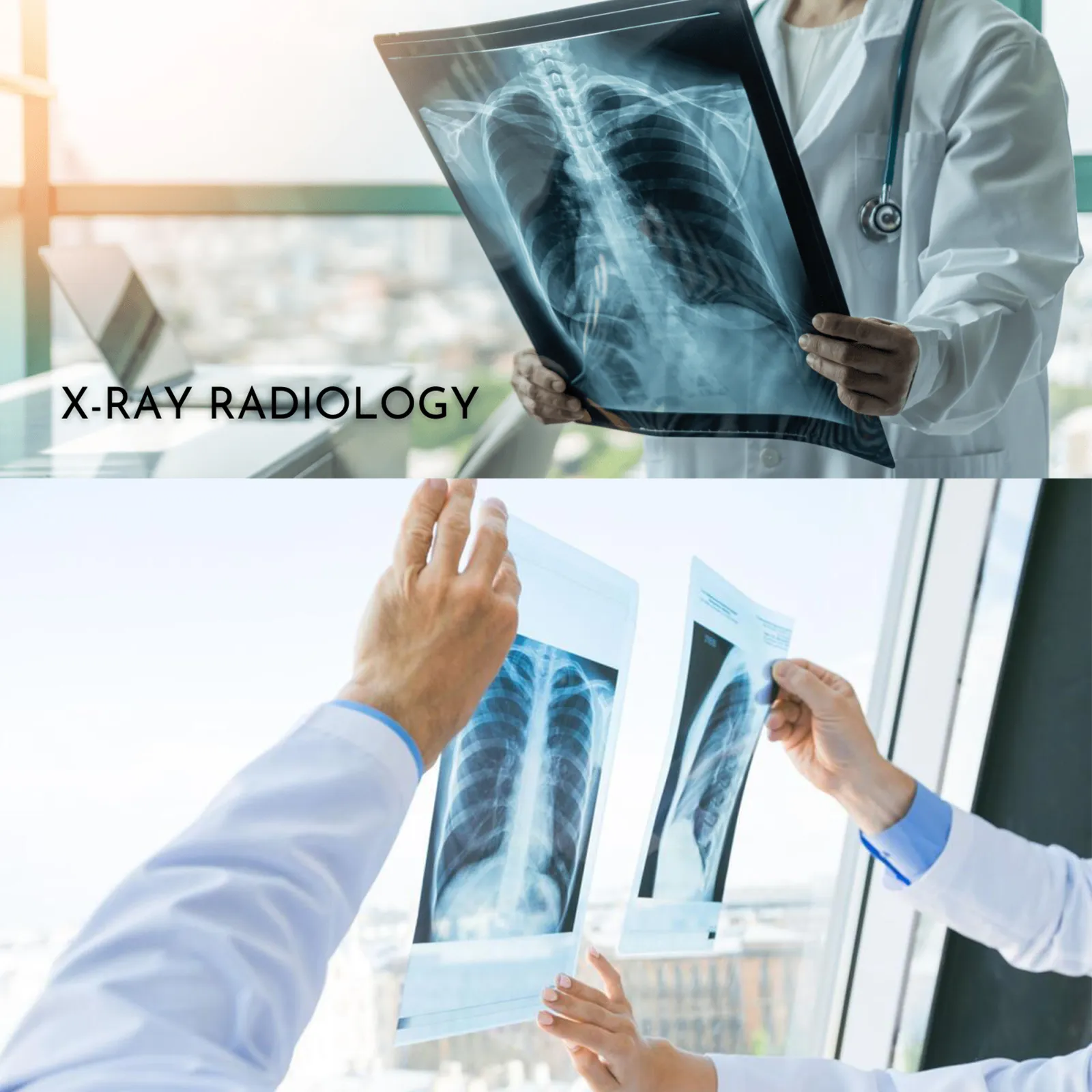 X-Ray