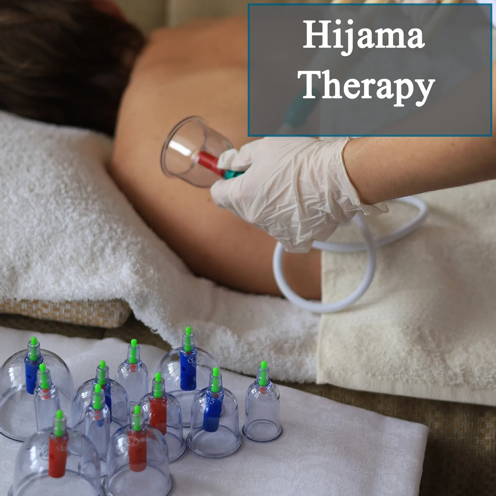 Hijama Therapy